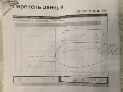 Мол так правильно после обучения.. Хватило этого грёбанного обучения минуты на 2
