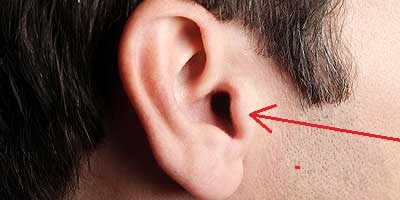 Extrinsic-ear-muscles.jpg